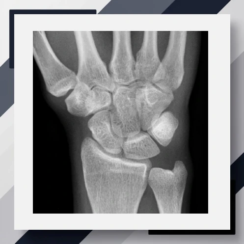 Carpal Bones Area Age Estimation