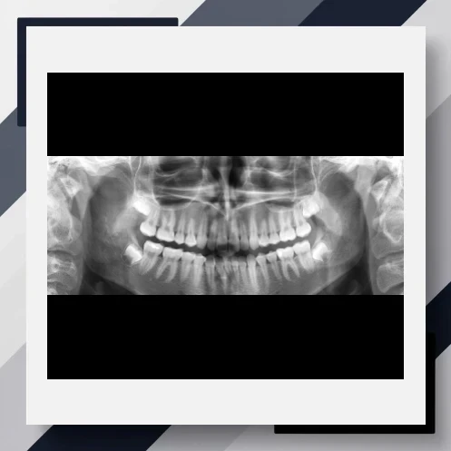 Age Estimation in Children